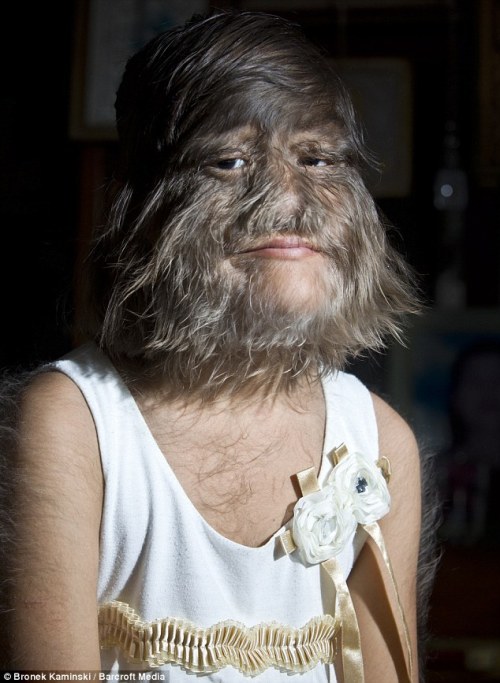 'Wolf Girl,' Supatra Sasuphan