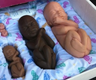 fetus Man hands out fetus dolls for Halloween