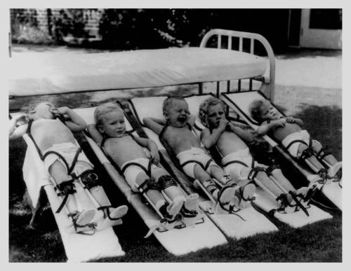 Polio-patients-on-boards-at-the-Texas-Scottish-Rite-Hospital-for-Children-in-Dallas-Texas