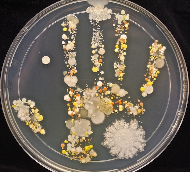 bacteria on a child's hand